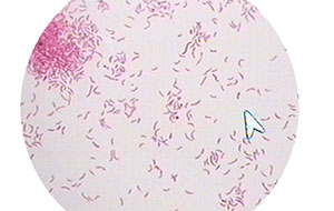什么是水中的熱源?